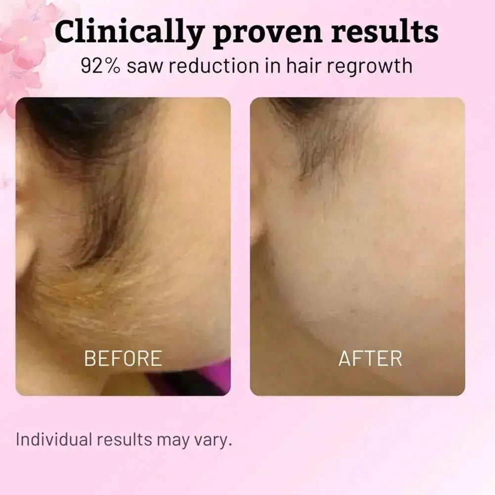 Hair Removal Care Serum Relieves Gentle Moisturizing Care Skin Smooth Nourishing Skin for After Hair Removal and Shaving Mysterious