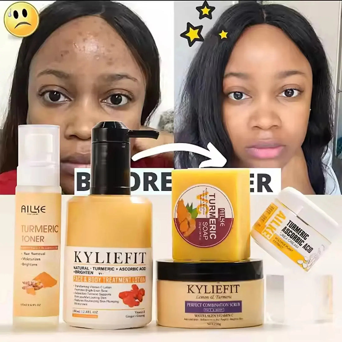 Organic Turmeric Skin Care Kit, Brighten, Clean, Remove Darkness, Spots, Acne, Lighten, Hydration, Exfoliate, Even Skin Tone Mysterious
