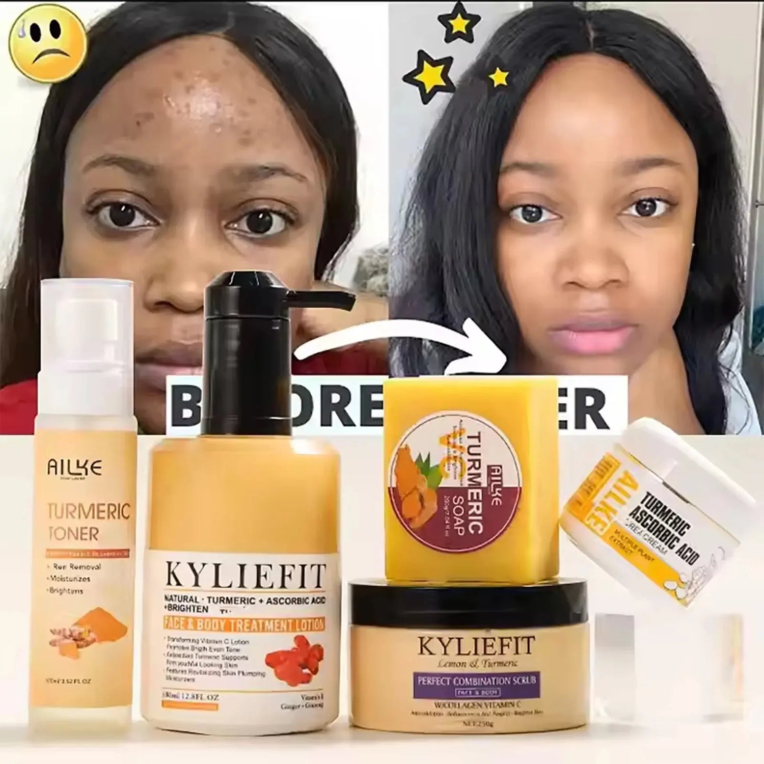Organic Turmeric Skin Care Kit, Brighten, Clean, Remove Darkness, Spots, Acne, Lighten, Hydration, Exfoliate, Even Skin Tone Mysterious