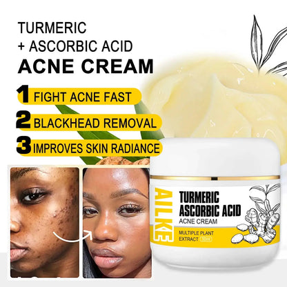 Organic Turmeric Skin Care Kit, Brighten, Clean, Remove Darkness, Spots, Acne, Lighten, Hydration, Exfoliate, Even Skin Tone Mysterious