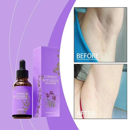 OceAura Cyperus Rotundus Oil for Hair Removal Prevent Hair Growth Products Remove Hair Inhibitor for Moisturizing Body Oil 60ml Mysterious