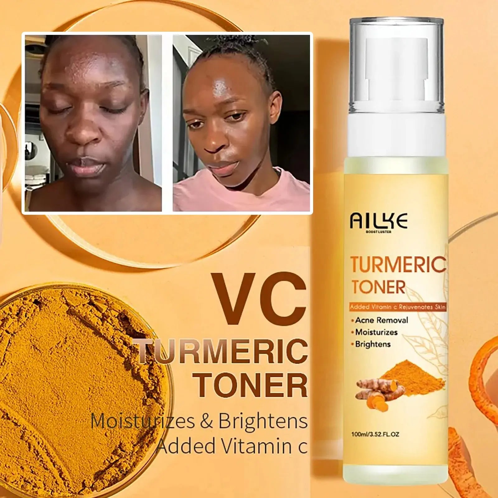 Organic Turmeric Skin Care Kit, Brighten, Clean, Remove Darkness, Spots, Acne, Lighten, Hydration, Exfoliate, Even Skin Tone Mysterious