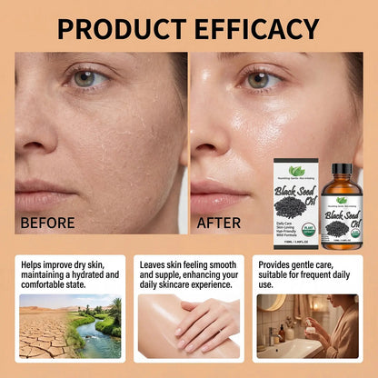 Organic Black Seed Oil Hair,Body &amp; Face Nourishing Moisturize Essence Oil Natural Smooth Skin Care Product Multi Effect Care Oil Mysterious